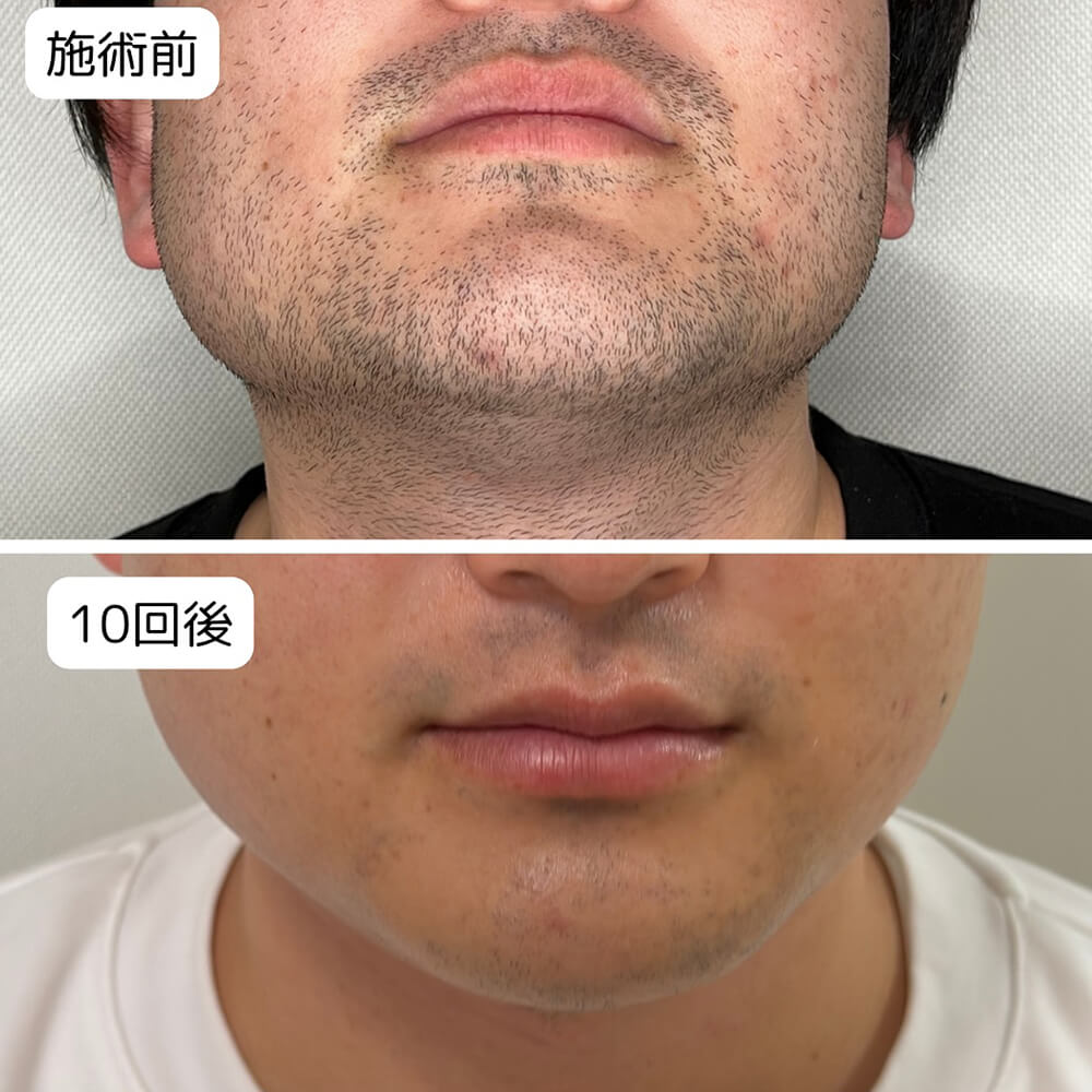 ビフォーアフター写真01