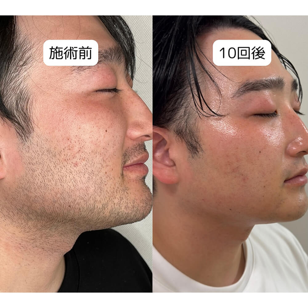 ビフォーアフター写真02