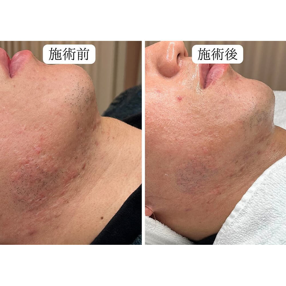 ビフォーアフター写真03