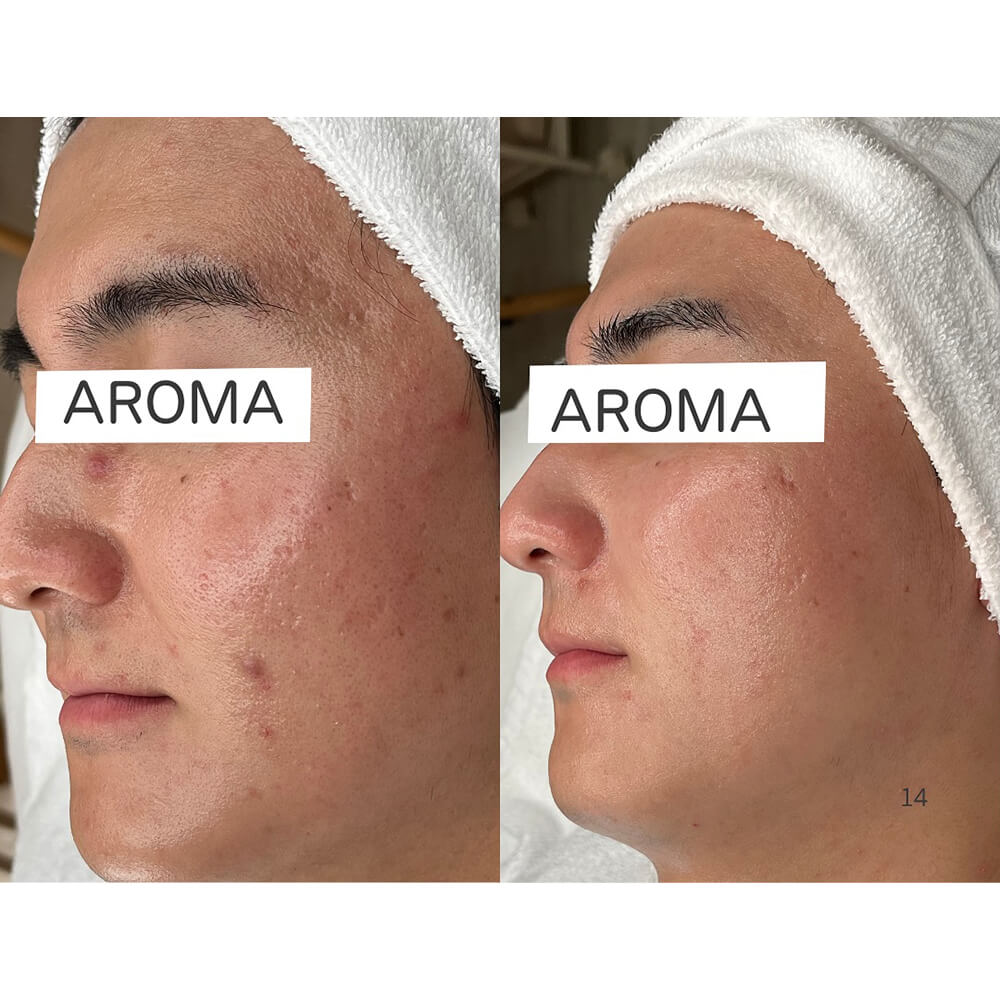 ビフォーアフター写真04