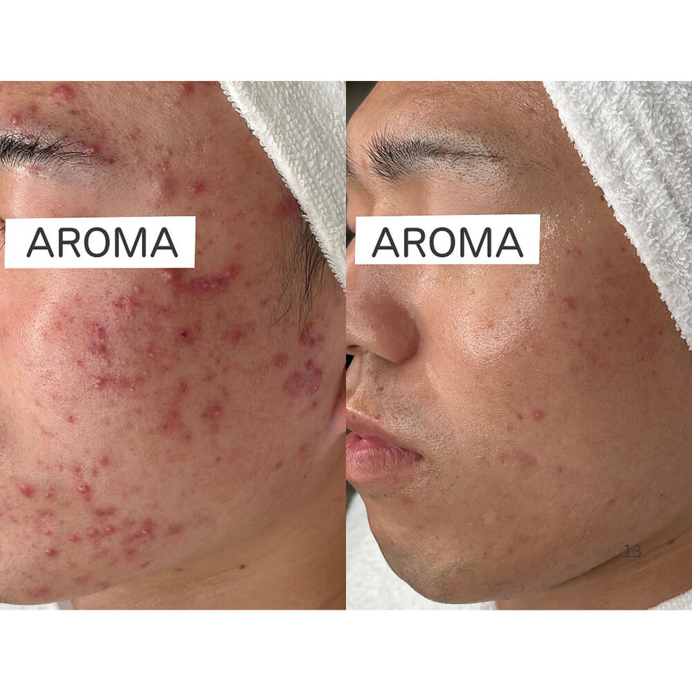 ビフォーアフター写真05