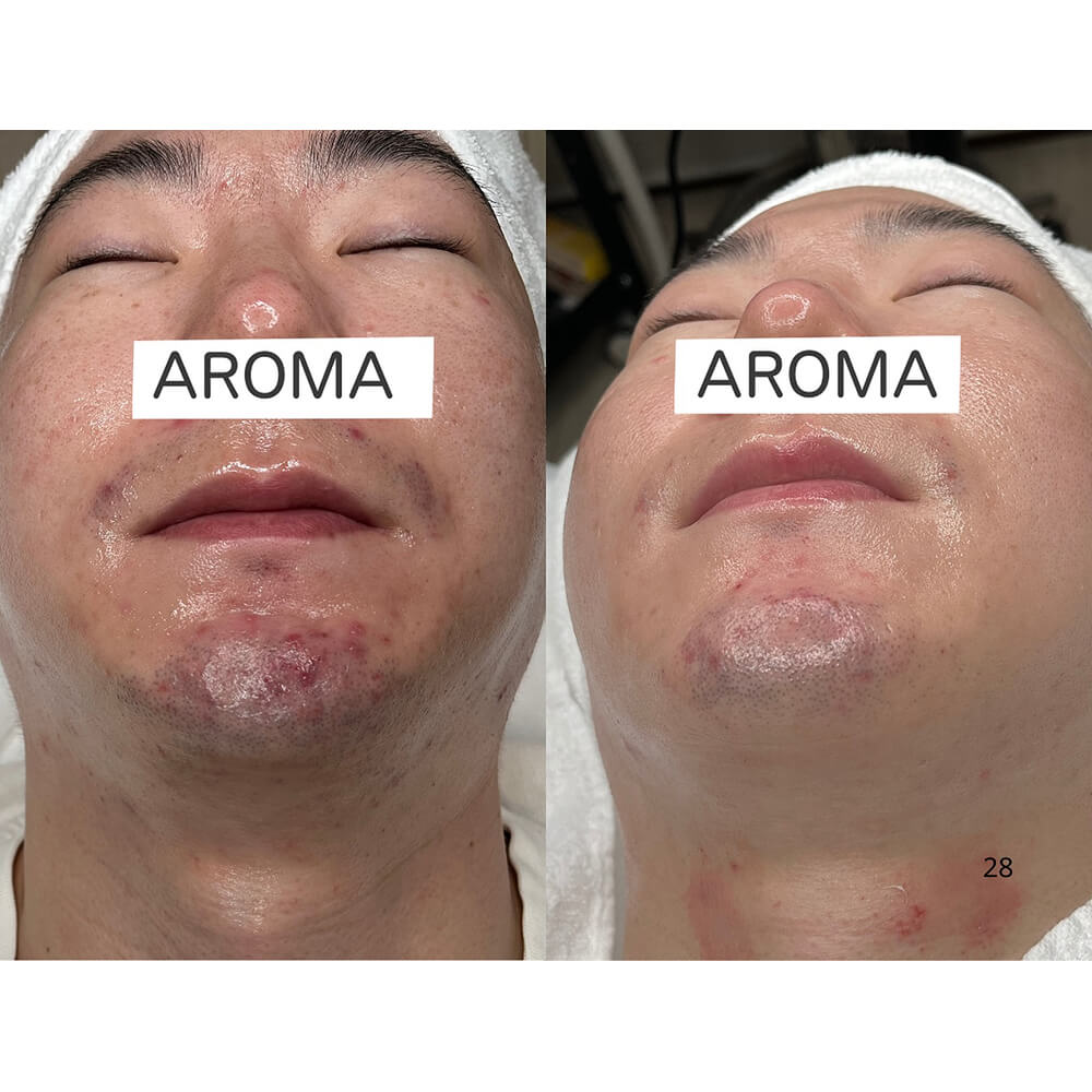 ビフォーアフター写真06