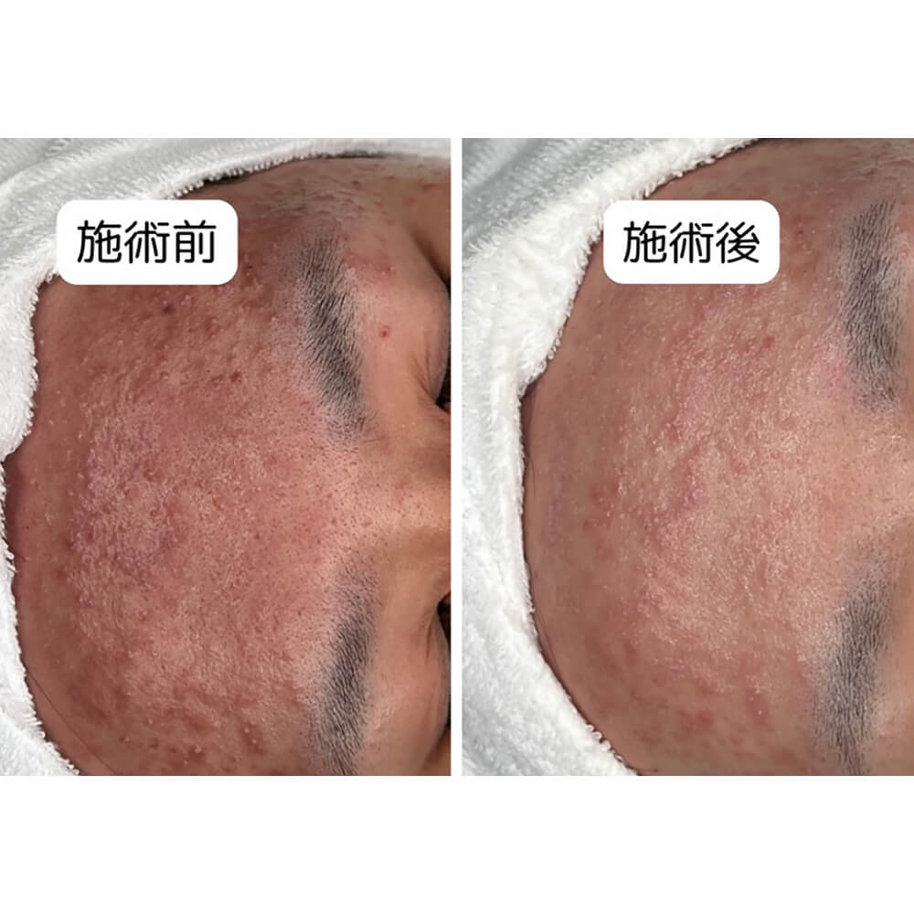 ビフォーアフター写真07