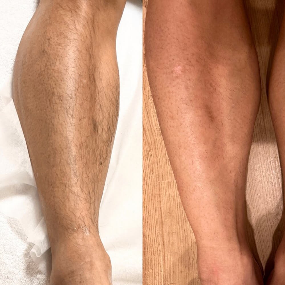 ビフォーアフター写真08