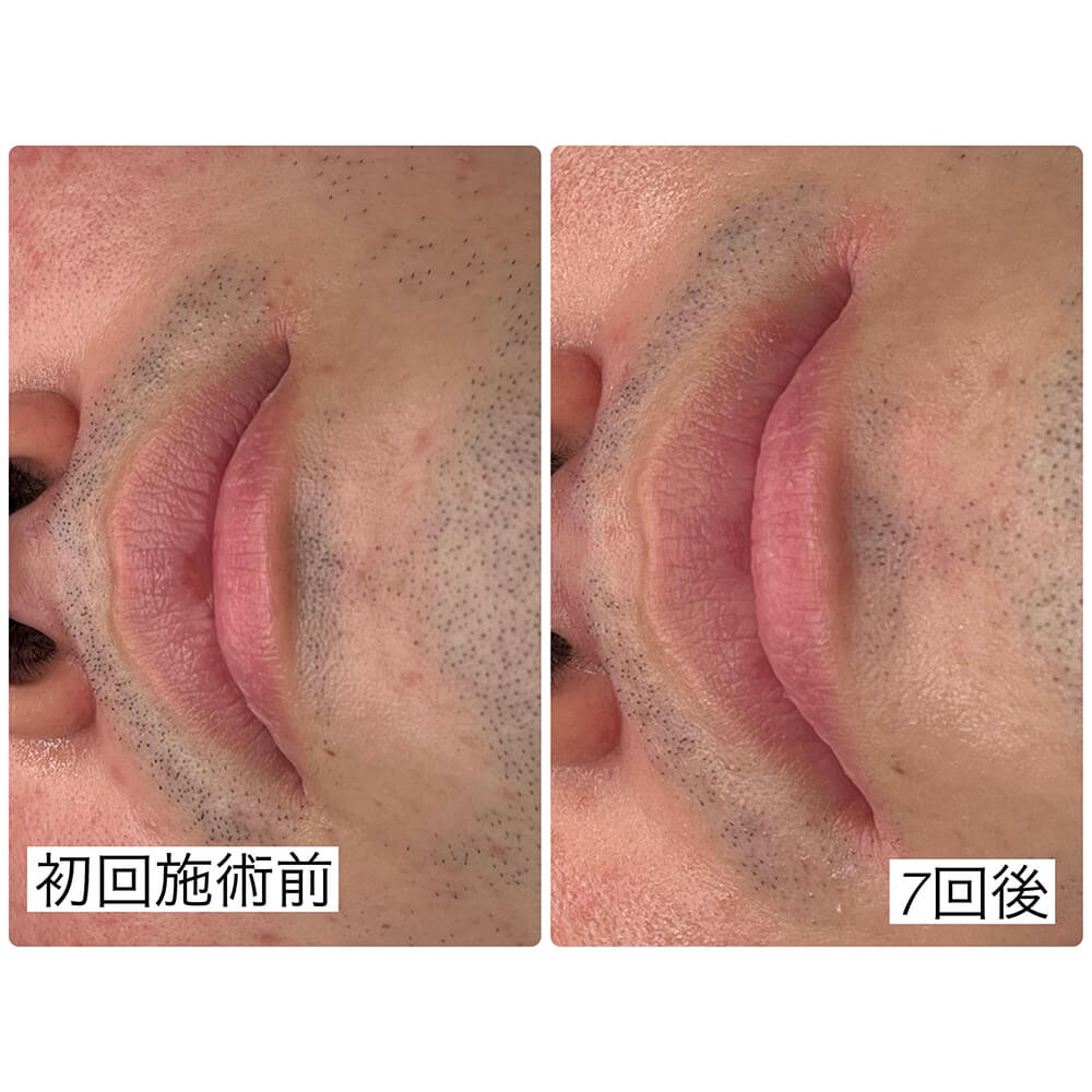 ビフォーアフター写真09