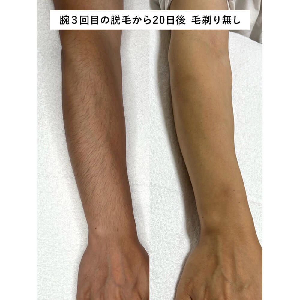 ビフォーアフター写真11