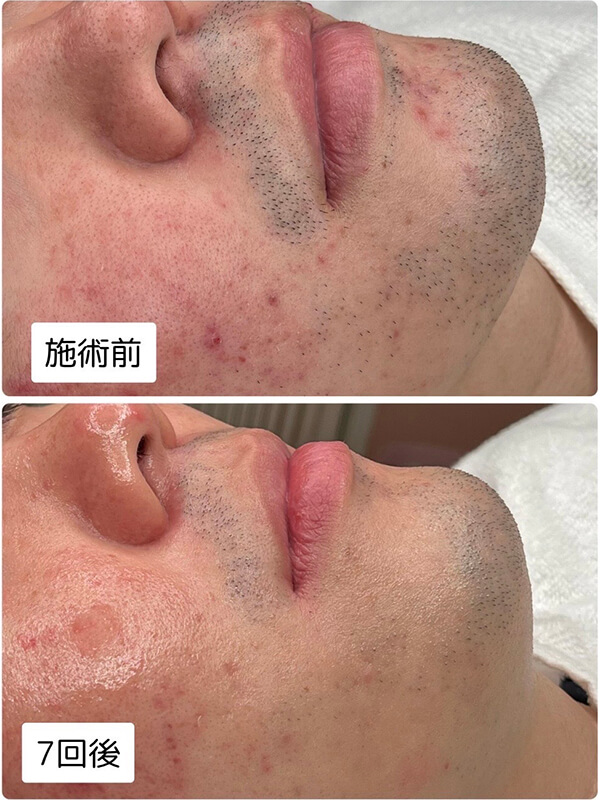 お客様の声　M様